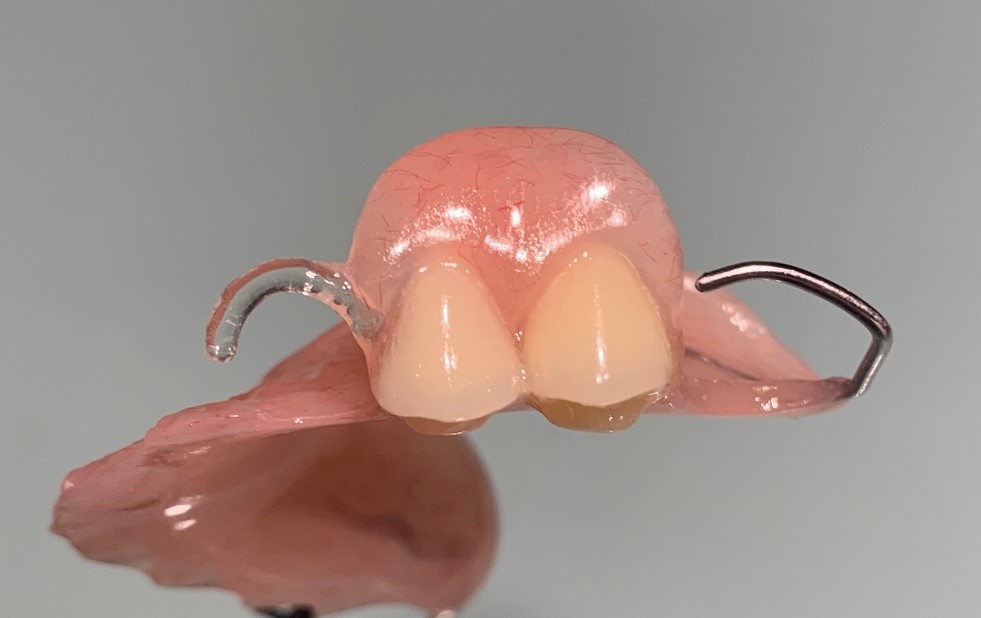 Partial Dentures With Clear Flexible Clasps Partial Dentures With Clear Flexible Clasps